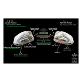 Lampe Trilobyte Gen1 Adventure Lights